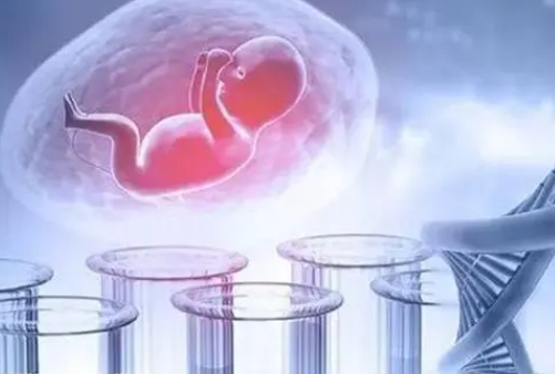 多囊卵巢综合征