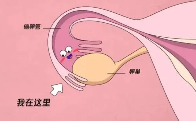 多囊卵巢综合征