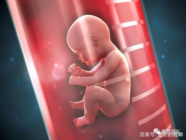 多囊卵巢综合征