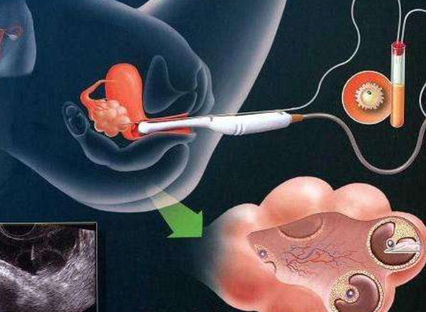 中年人喝什么品牌奶粉好一点