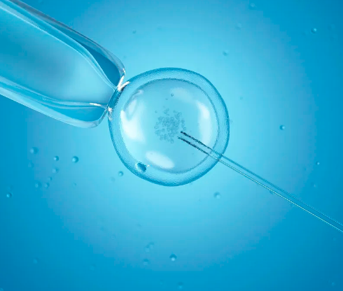 卵子捐赠